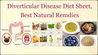 Diverticular Disease Diet Sheet Best Natural Remdies [upl. by Ulrick]