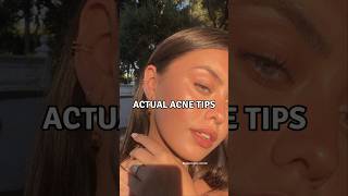 6 Actual Acne Tips viralshorts acnetreatment acnescars [upl. by Stryker]