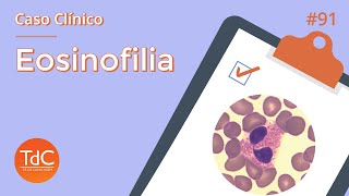 Abordagem da Eosinofilia Episódio 91 [upl. by Notsirhc455]