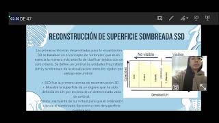 Tomógrafo Tipos de reconstrucciónes [upl. by Zarihs]