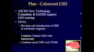 Endoscopic Submucosal with diagnostic Laparoscopy  PG MIS Colorectal Surgery [upl. by Ahsieker]