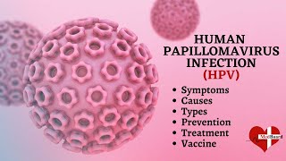 Human papillomavirus infection  HPV  What is HPV amp How do you get it [upl. by Hance77]