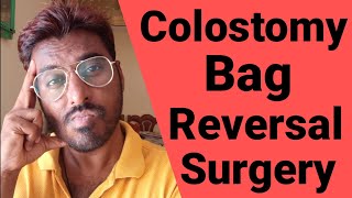 क्या Colostomy Bag ki reversal surgery करनी चाहिए  Tips for Stoma closure surgery  Rectum Cancer [upl. by Carolus65]