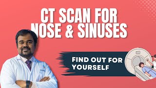 CT scan Nose Sinuses  Sinusitis  Dr G V K Chaitanya Rao [upl. by England]