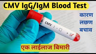 cmv test in hindi  CYTOMEGALOVIRUS TEST  cmv igg igm blood test [upl. by Regnij]