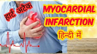 Myocardial infarction in hindi Part 2 [upl. by Demott]