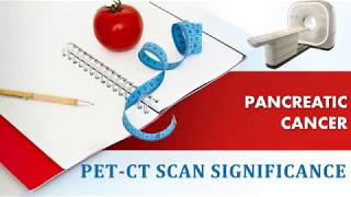 Significance of PETCT scan in Pancreatic Cancer Treatment [upl. by Ynohtna342]