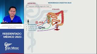 Gastroenterología  5 Hemorragia Digestiva Baja [upl. by Ellerehc]