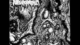 Neuropathia split wth Grossmember [upl. by Kiraa66]