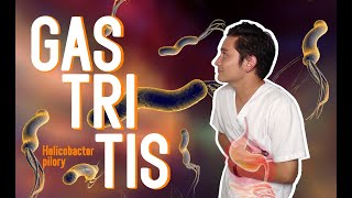 TODO LO QUE DEBES SABER SOBRE LA GASTRITIS [upl. by Terryl]