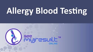 Allergy Blood Testing [upl. by Asenav]