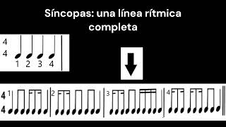 Síncopas Clase III [upl. by Pang]