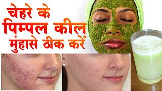 pimple ke gharelu upay चेहरे पर मोजूद पिम्पल कम कैसे करें  how to reduce pimples from face [upl. by Philipines]