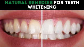 Natural Remedies For Teeth Whitening [upl. by Aynam]