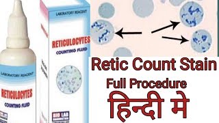 How to stain reticulocytes count  Reticulocytes count stain procedure  reticulocyte count [upl. by Idihc]