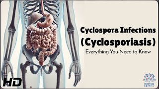 Cyclospora Infection The Parasite You Didn’t Know About [upl. by Nyberg]