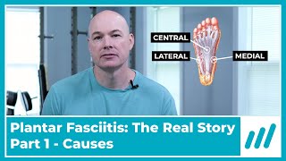 Plantar Fasciitis Part 1 What is it What Caused it [upl. by Casar461]