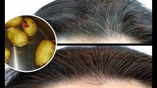 Elimina Las Canas Con Solo Enjuagar Tu Cabello Con Agua De Cascara De Papa [upl. by Ahselaf]