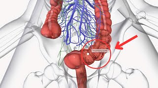 Colorectal Cancer CRC The Gut Truth That You Must Know  Modern Medicine [upl. by Tuinenga]