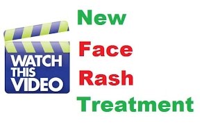 How To Get Rid of Face Rash At Home [upl. by Cesar]