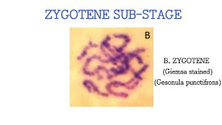 Zygotene substage of Prophase 1 Grasshopper Gesonula punctifrons testes [upl. by Miyasawa]