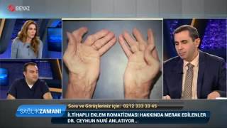 Romatoid Artrit  İltihaplı Eklem Romatizması  Dr Ceyhun Nuri  Beyaz TV Sağlık Zamanı Programı [upl. by Euphemia]