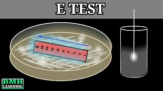 E Test  E Test For Antibiotic Susceptibility  MIC Determination By E Test  Epsilometer Test [upl. by Akirret]