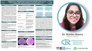 Embryonal Rhabdomyosarcoma  Dr Rishika Masna [upl. by Sira821]