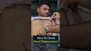 How To Check Navel Displacement naveldisplacement shortsfeed ytshortsindia ytshorts ytviral [upl. by Eric]