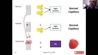 An Introduction to Cavernoma Genetics with David White Science of Cavernoma Series [upl. by Vrablik]