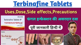 Terbinafine tablets ip 250 mg  Terbinaforce tablet uses dose side effects  फंगल इन्फेक्शन की दवा [upl. by Evans]