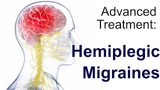 Hemiplegic Migraine Treatment [upl. by Claudine396]