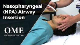 Nasopharyngeal Airway NPA Insertion [upl. by Asylem]