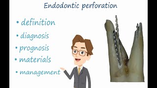 The Ultimate Guide to Endodontic Perforation Management What every dentist must know [upl. by Ahsas600]