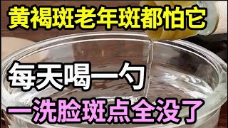 手上脸上都是斑？厨房一物是祛斑法宝，早上喝一勺，2天后一洗脸黄褐斑、老年斑就哗哗往下掉！气色比20年前还好！【饮食养生大智慧】 [upl. by Aenyl773]