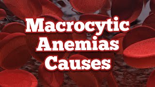 Causes of Macrocytic Anemias  Mnemonic [upl. by Nancy]