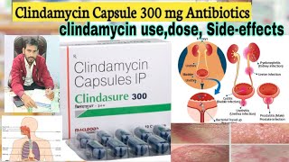 Clindamycin capsules 300 mg  Clindamycin 300 mg capsule [upl. by Yentyrb363]