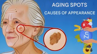 5 Real Causes of Aging Spots You Should Know Compilation [upl. by Frere]