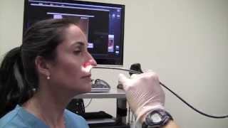 Esophagoscopy Without Sedation TransNasal Esophagoscopy Esophagus Exam Endoscopy [upl. by Alema]