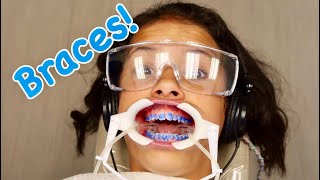 First Day with Braces Braces Routine [upl. by Nilad]