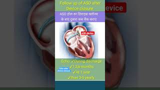 when do Echo after asd device closure l echo asd shorts [upl. by Richer]