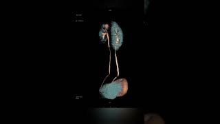 CT UROGRAPHY radiology radiologist viral radiographer mri imaging radiologylife [upl. by Vallie]