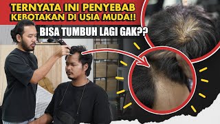 Masih Muda Kok Rambut Mulai TIPIS Begini Cara Mengatasinya… [upl. by Avitzur64]