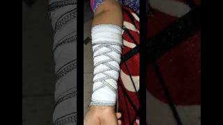 Reverse spiral bandage procedure  bandaging nursing procedure shorts nursing bandage  medical [upl. by Fidelia989]