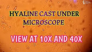 Hyaline cast under microscopeurine cast under microscopeBest and Clear view at 10X and 40X [upl. by Kalikow469]