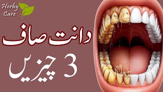 Top 3 Effective Home Remedies to Remove Plaque and Tarter [upl. by Ninazan]