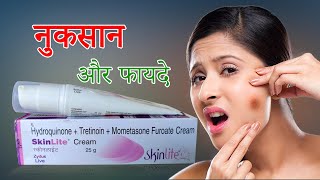 Skinlite Cream  नुक्सान और फायदे  Meri Dawai [upl. by Aihtennek]