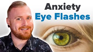 Does Anxiety Cause Eye Flashes [upl. by Anivid138]