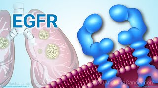 Understanding NSCLC Treatment When You Have an EGFR Mutation [upl. by Notanhoj]