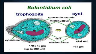 Balantidium coli [upl. by Esetal]